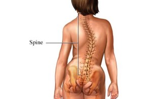 Child with Scolisis